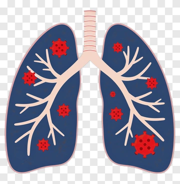 Lungs With Virus PNG