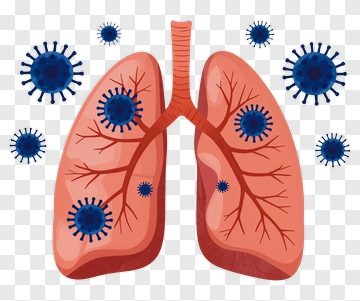 Lungs Infected With Viruses PNG
