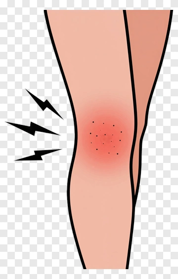 Knee Pain Illustrated PNG